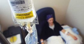 chemotherapy